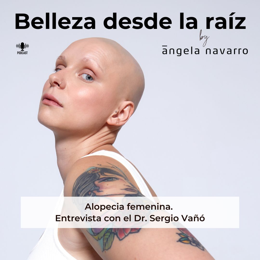 Alopecia Femenina Dr Sergio Vaño