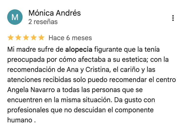 alopecia areata peluca