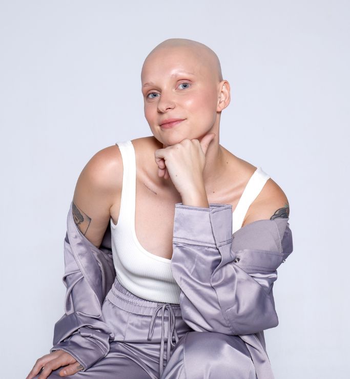 alopecia femenina calva sin peluca